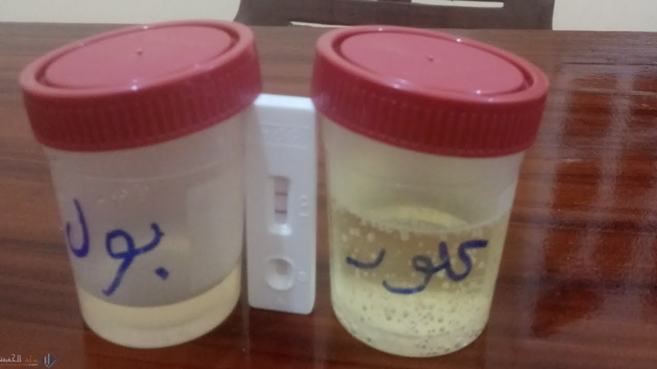طريقة معرفة نوع الجنين بالكلور بالصور