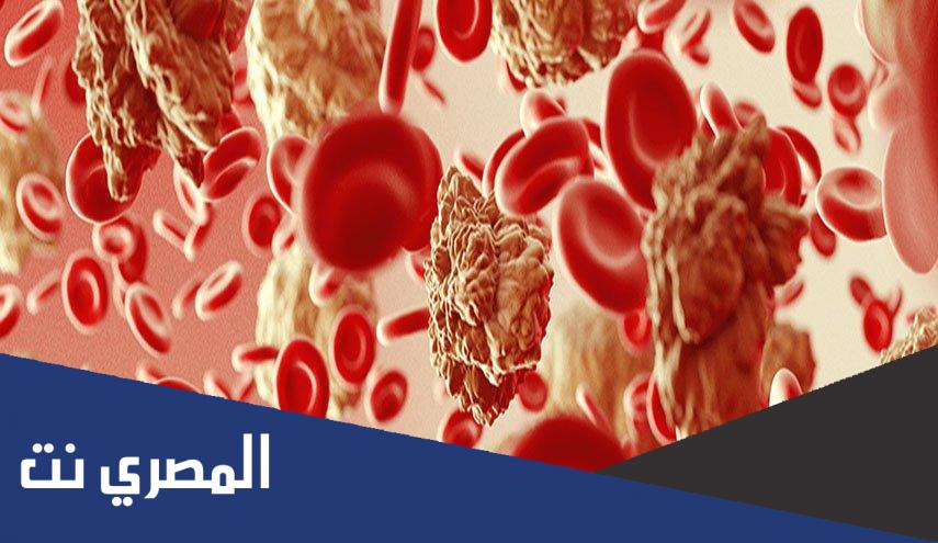 أعراض سرطان الدم