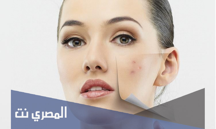 اعراض الحمل على الوجه 2021