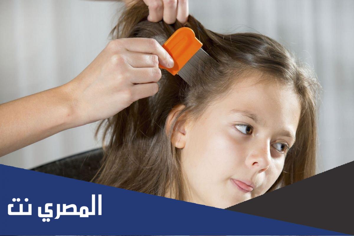 شامبو Charlieu للقضاء على قمل الشعر