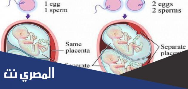 مراحل تكوين التوأم في رحم الأم
