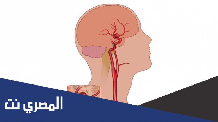 علاج أم الدم البطينية اليسرى
