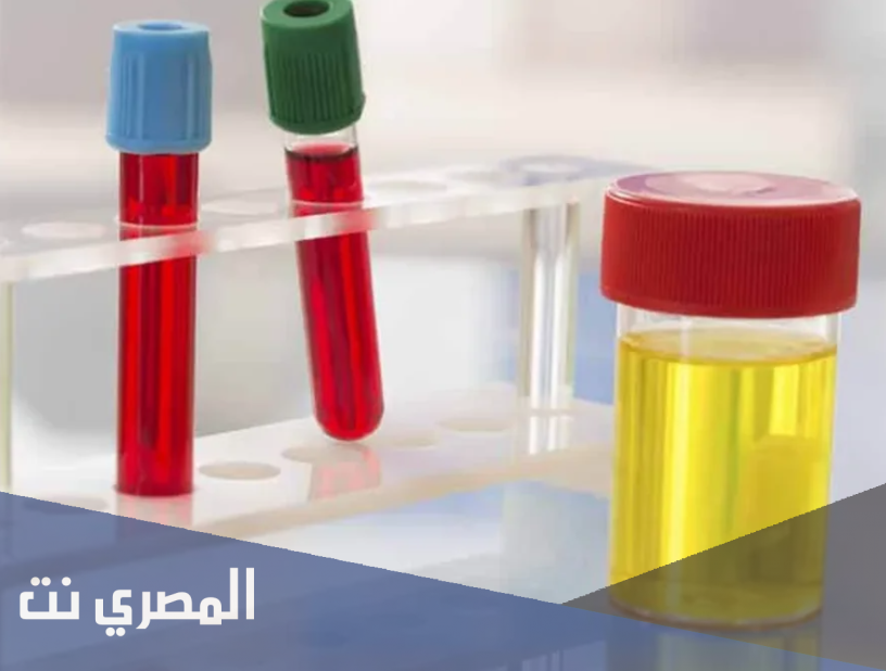 أسباب وجود الدم في البول