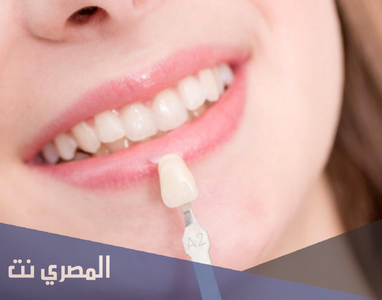 أهم الأسباب المرتبطة بتسوس الأسنان، و تأثير ذلك على حياتك الاجتماعية.