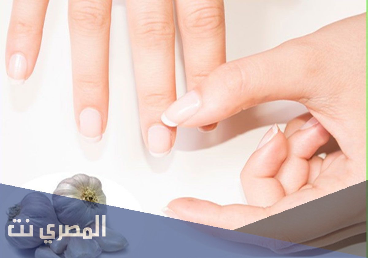 استعمال الثوم للعناية بجمال الشعر والأظافر