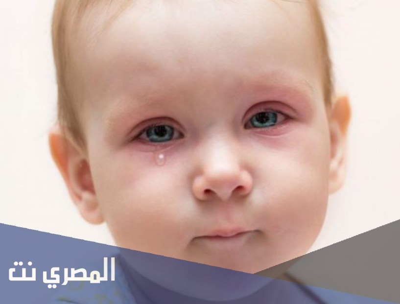 تعرفي سيدتي على أسباب إحمرار العين عند طفلك وعلاجه