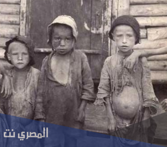 حقائق صادمة عن مجاعة مينيسوتا تم الكشف عنها