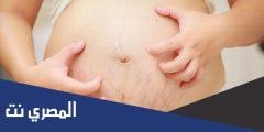علاج تشققات الحمل