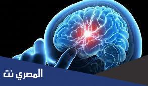 علاج نزيف الدماغ بطرق فعالة وحديثة
