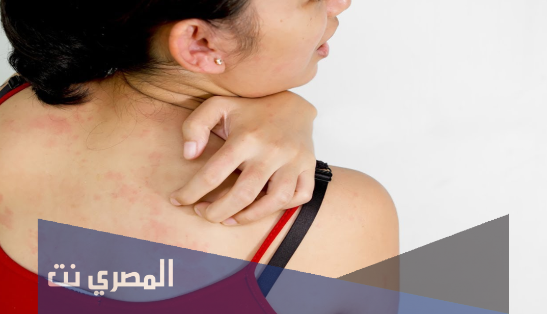 هذه أمور غير متوقعة تسبب لك الحكة