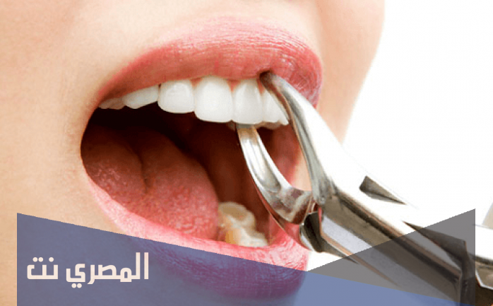 ما معني رؤية خلع الضرس في المنام