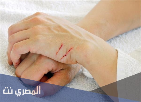 ما هو تفسير حلم جرح اليد والجسم فى المنام