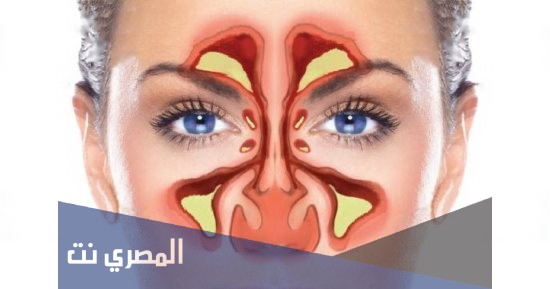 تابونكس Tabunex بخاخ لعلاج الجيوب الأنفية وتأثيره
