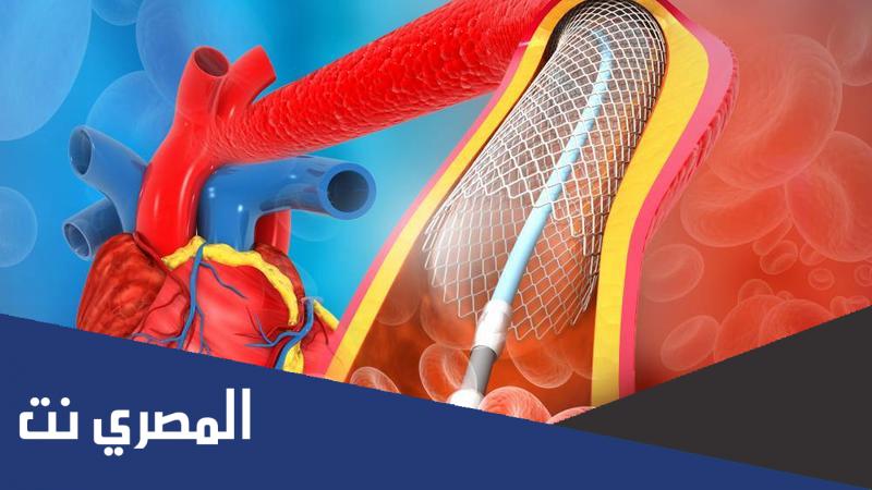 اضرار عملية دعامات القلب