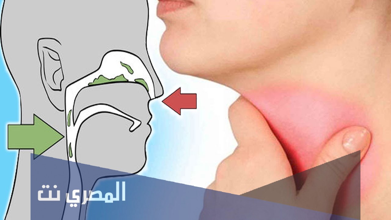 ميكوسول Mucosol شراب مذيب ومنظم للبلغم وتأثيره