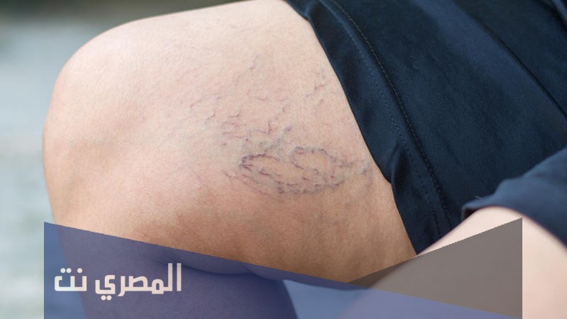 أندوريفابان أقراص لمنع تجلط الدم داخل الاوردة وتأثيره