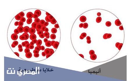 Feroglobin مكمل غذائي لعلاج الأنيميا