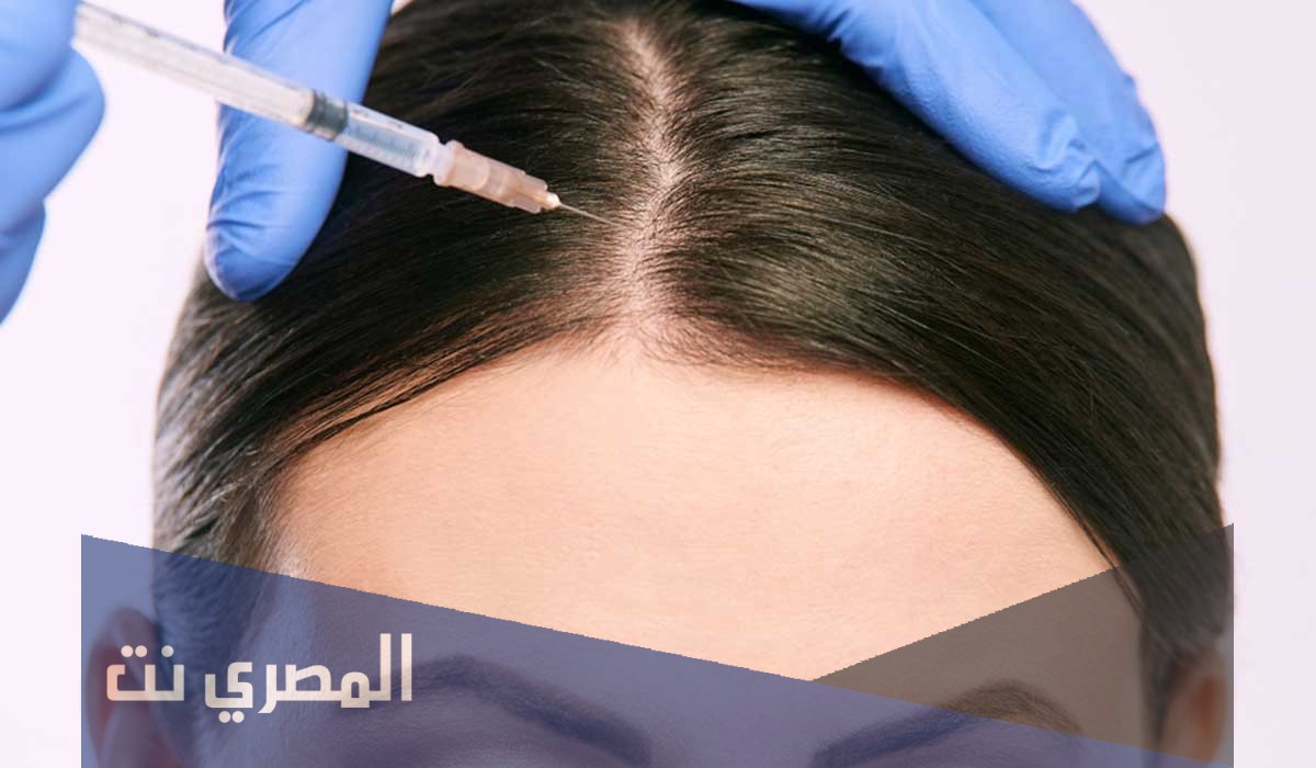 حقن البلازما للشعر | الفوائد والأضرار والتكلفة