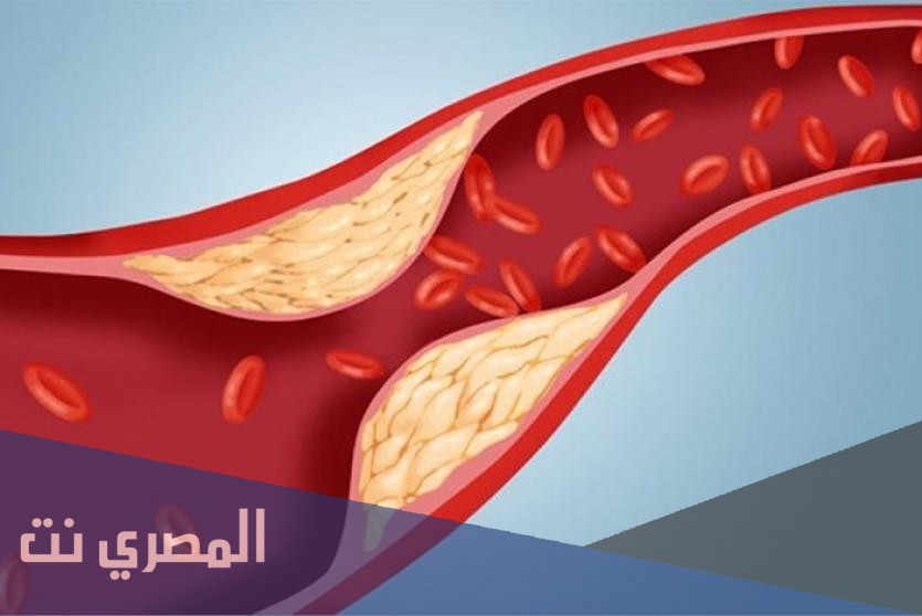 لورفاست Lorvast أقراص لعلاج ارتفاع الكولسترول وفعاليته