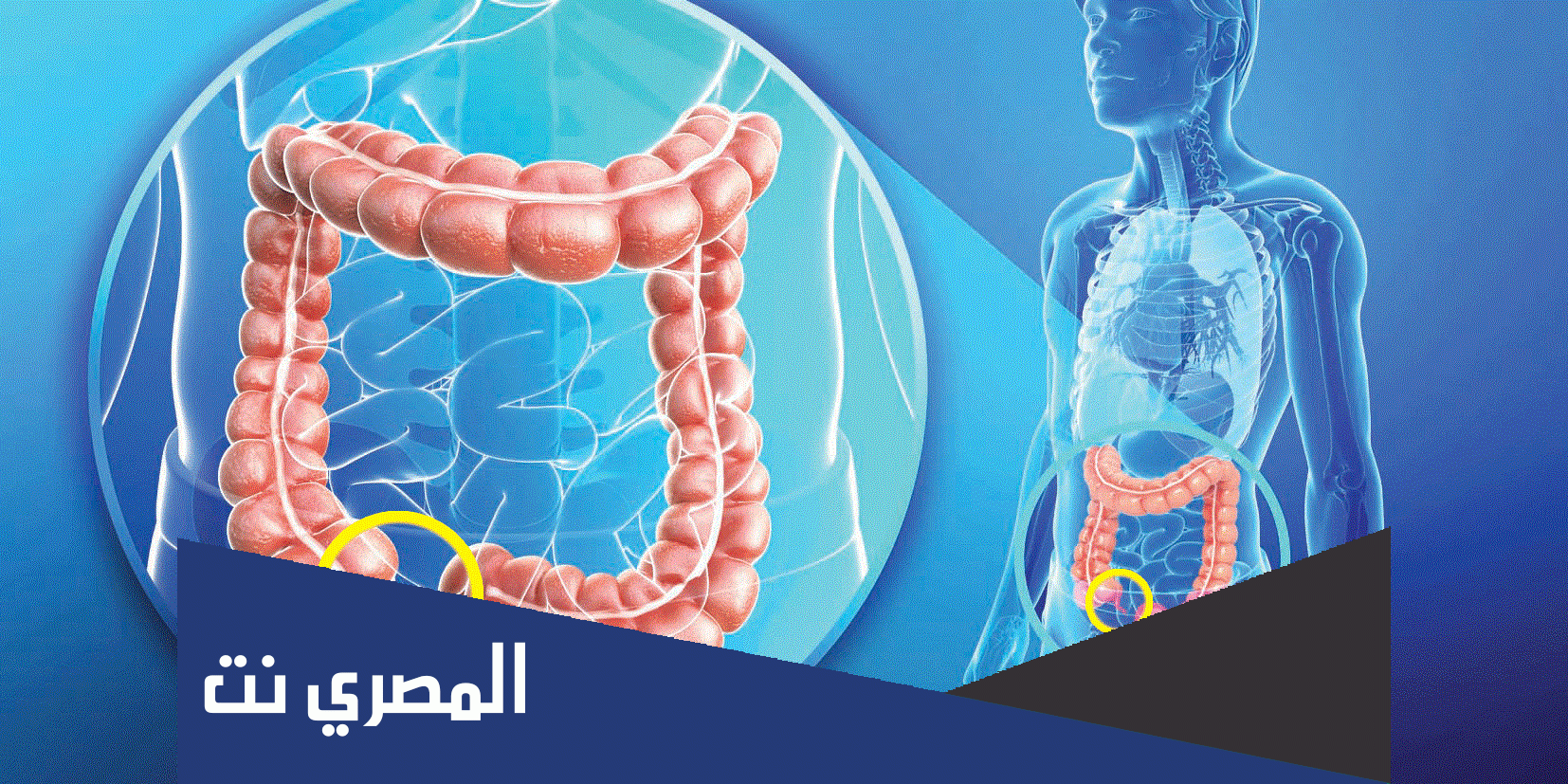 أسباب انفجار الزائدة الدودية وعلاماتها