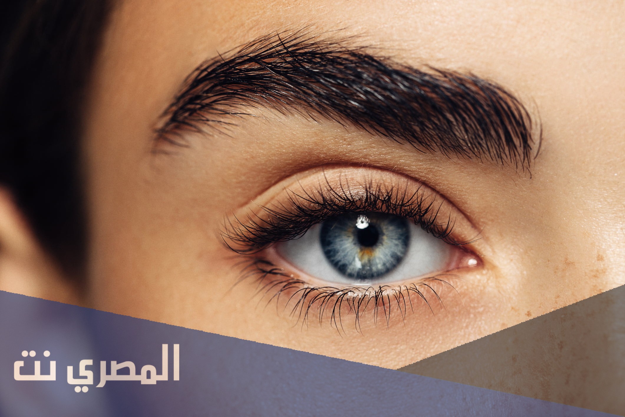 أسباب تساقط الحواجب وعلاجه