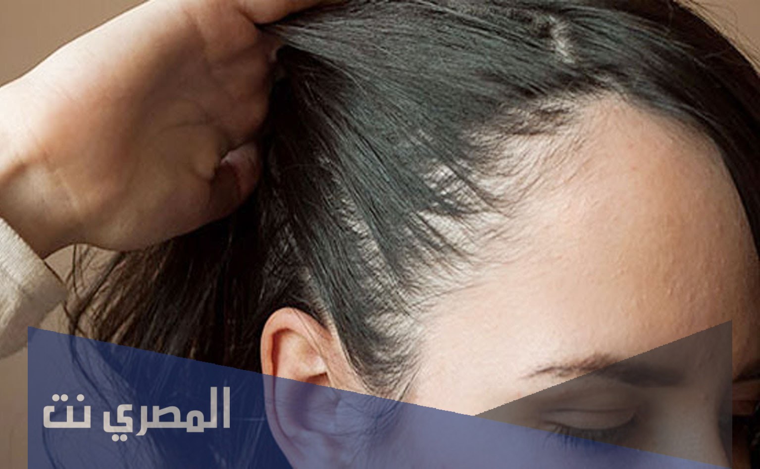 أسباب ظهور فراغات في فروة الرأس وعلاجها