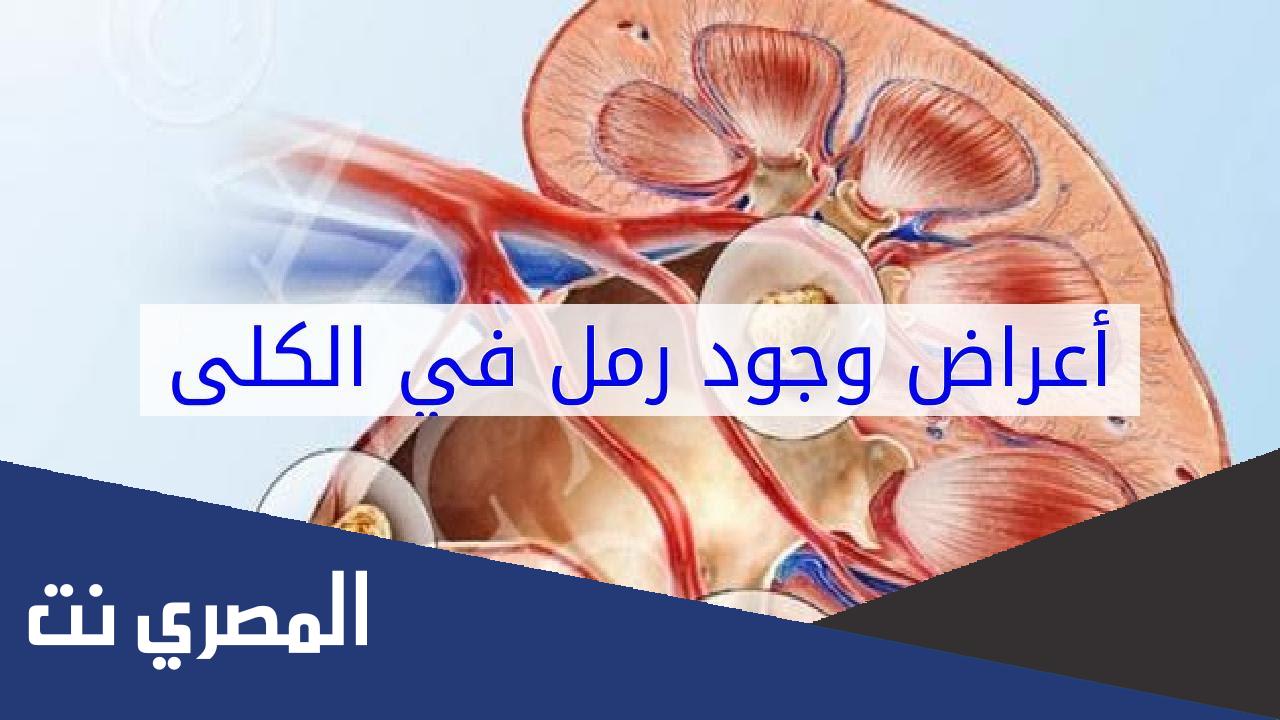 أعراض وجود الرمل في الكلى