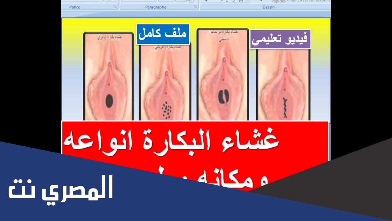 أنواع غشاء البكارة السليم بالتفصيل