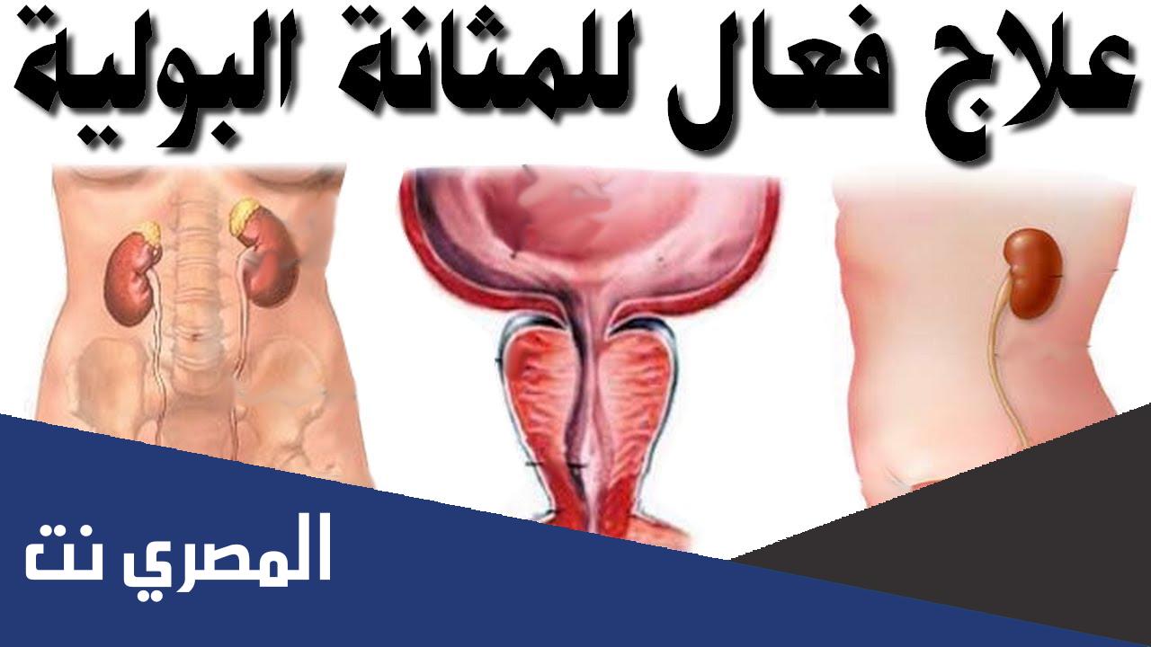 اسباب التهاب جدار المثانة