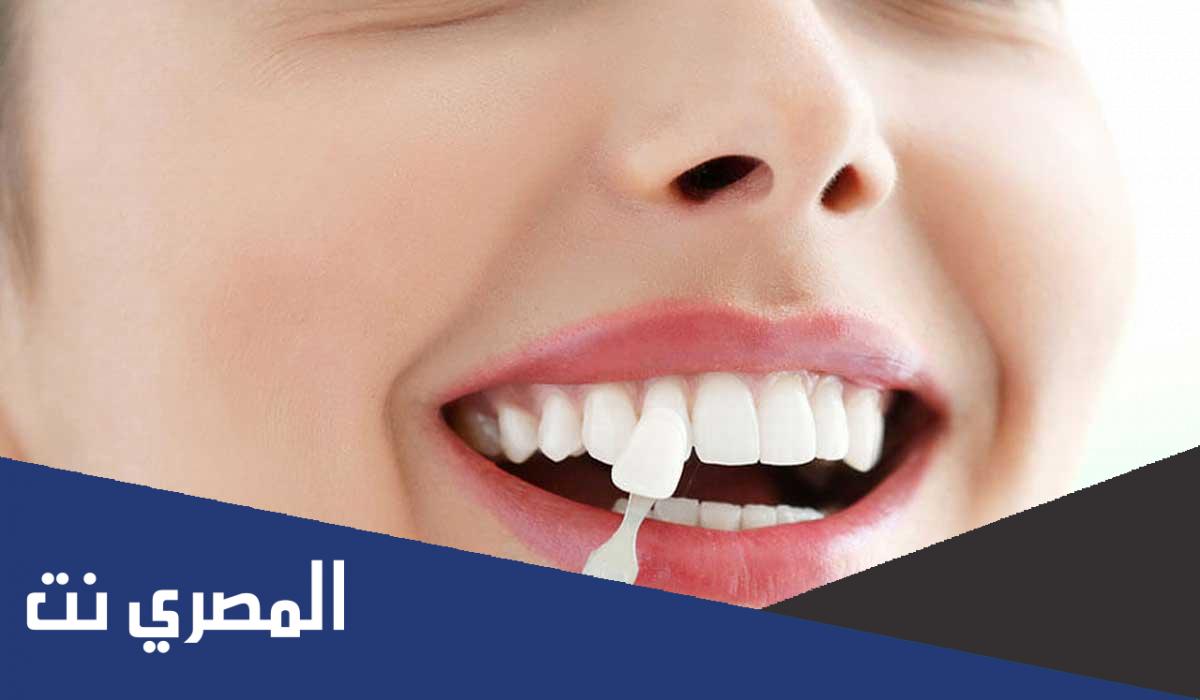 اسعار تركيبات الاسنان الزيركون والبورسلين في مصر