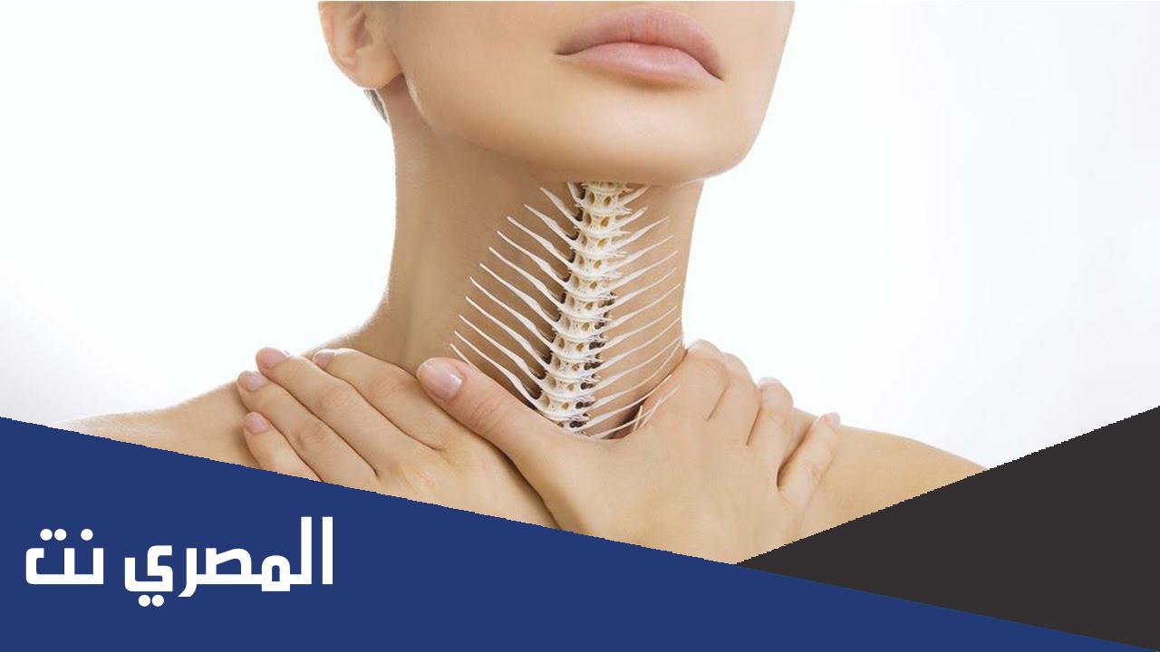 اضرار بلع شوكة السمك وعلاجه