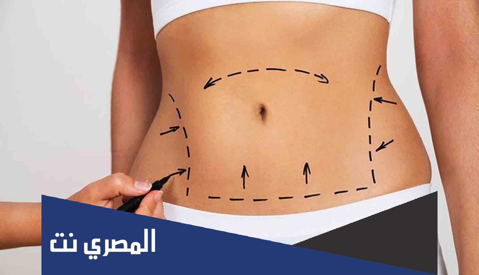 اضرار عمليات شد البطن