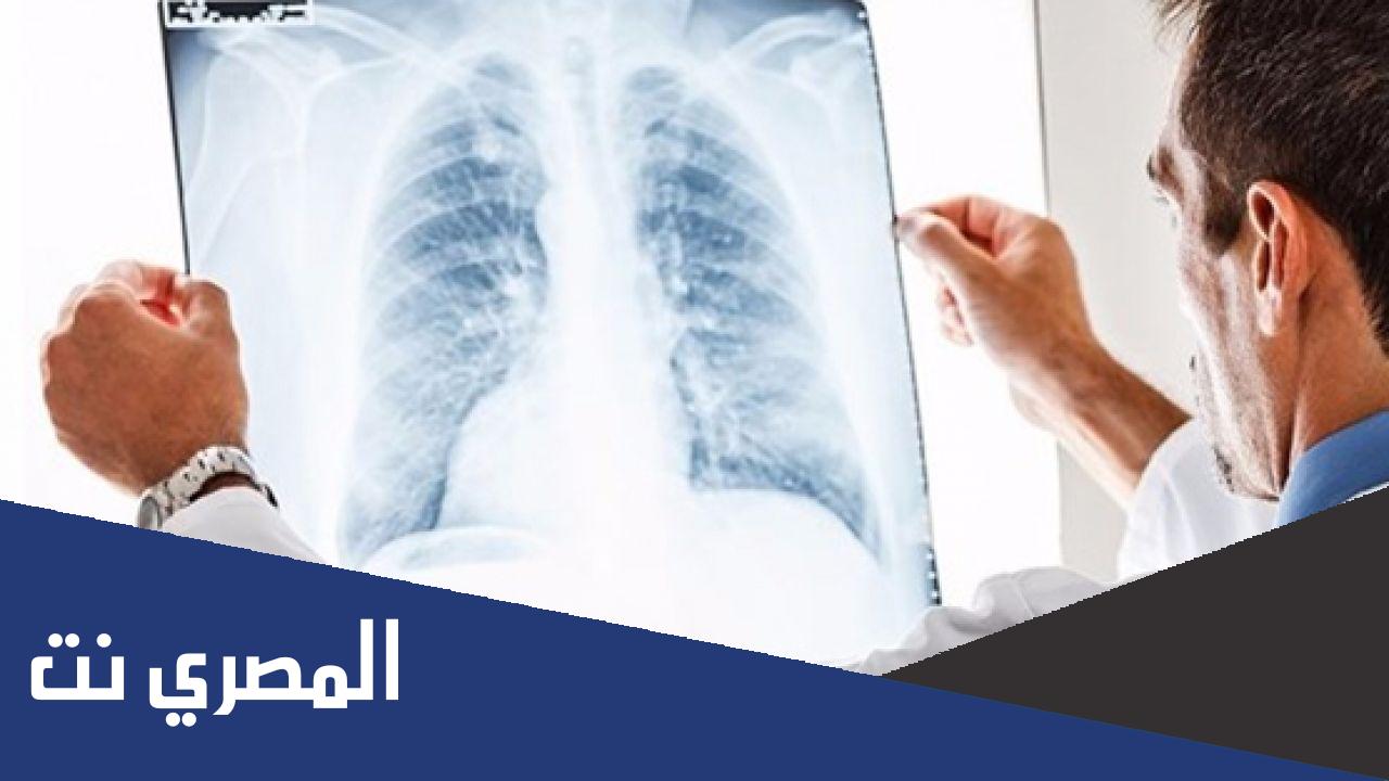اعراض ثقب الرئة