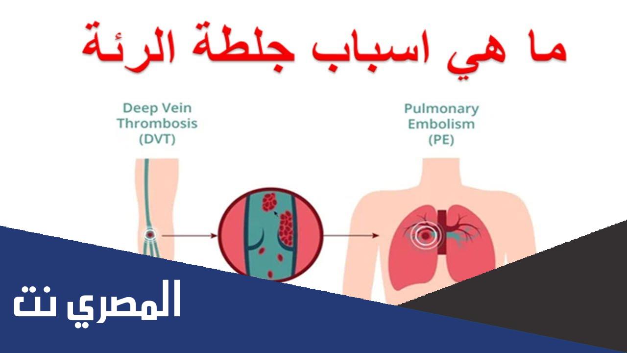 اعراض جلطة الرئة وعلاجها