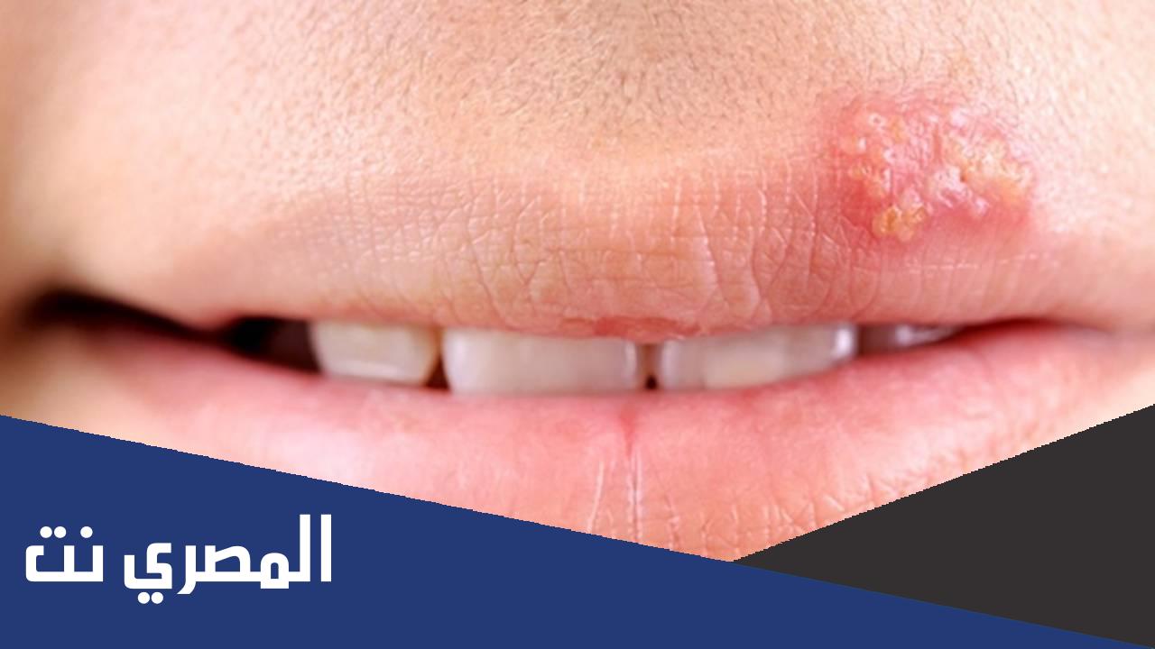 اعراض سرطان الفم في بدايته