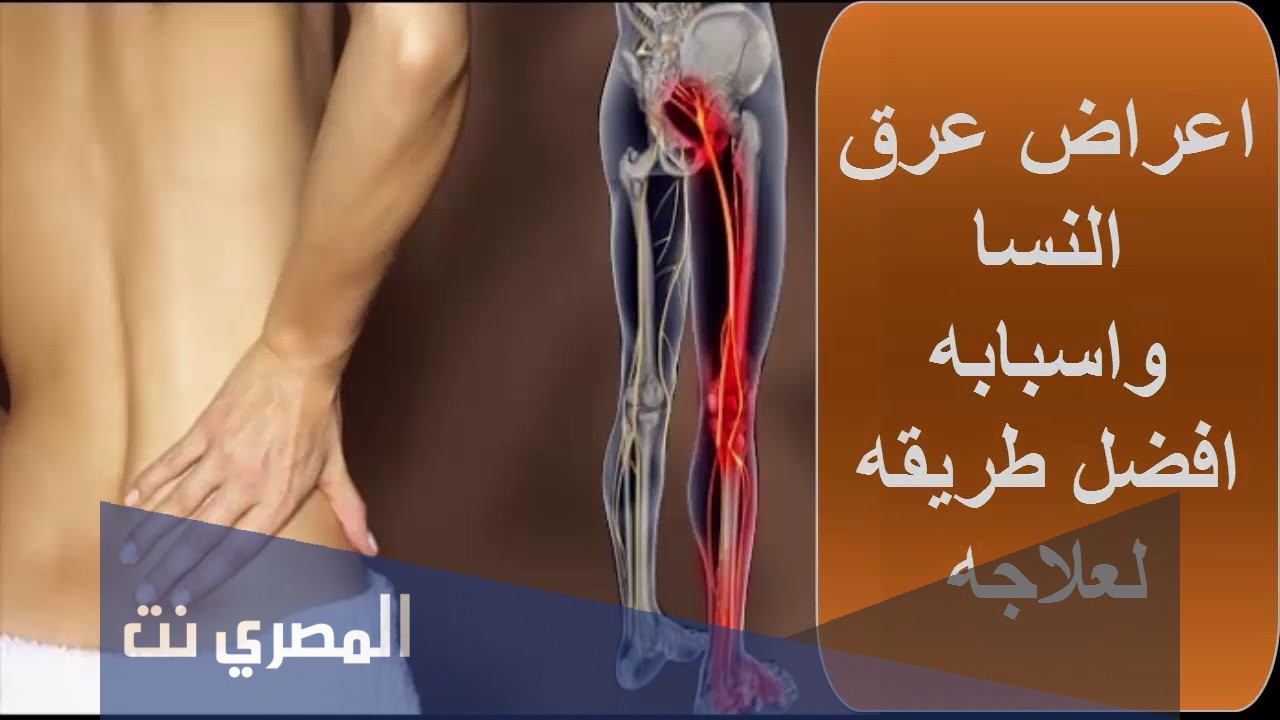 اعراض عرق النسا في الرجل اليمنى وعلاجه