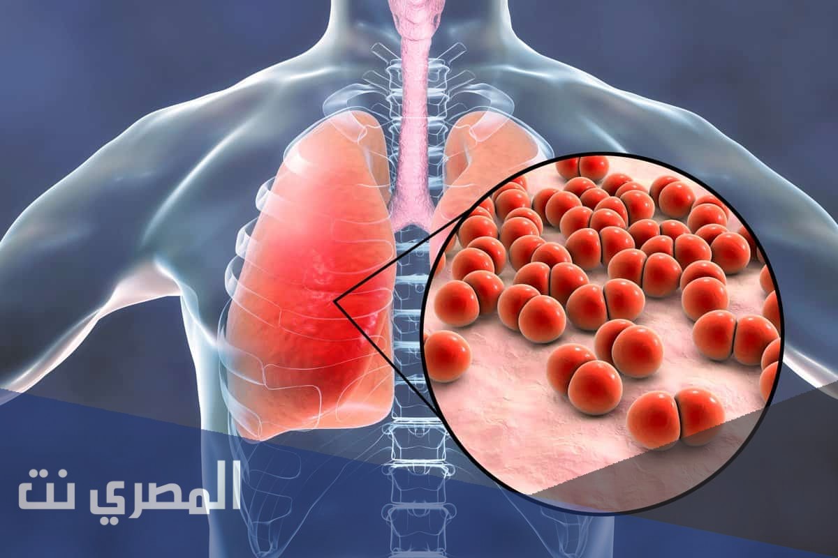 اعراض مرض السل وانواعه