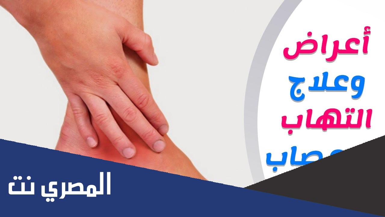 افضل ادوية علاج التهاب الاعصاب الطرفية
