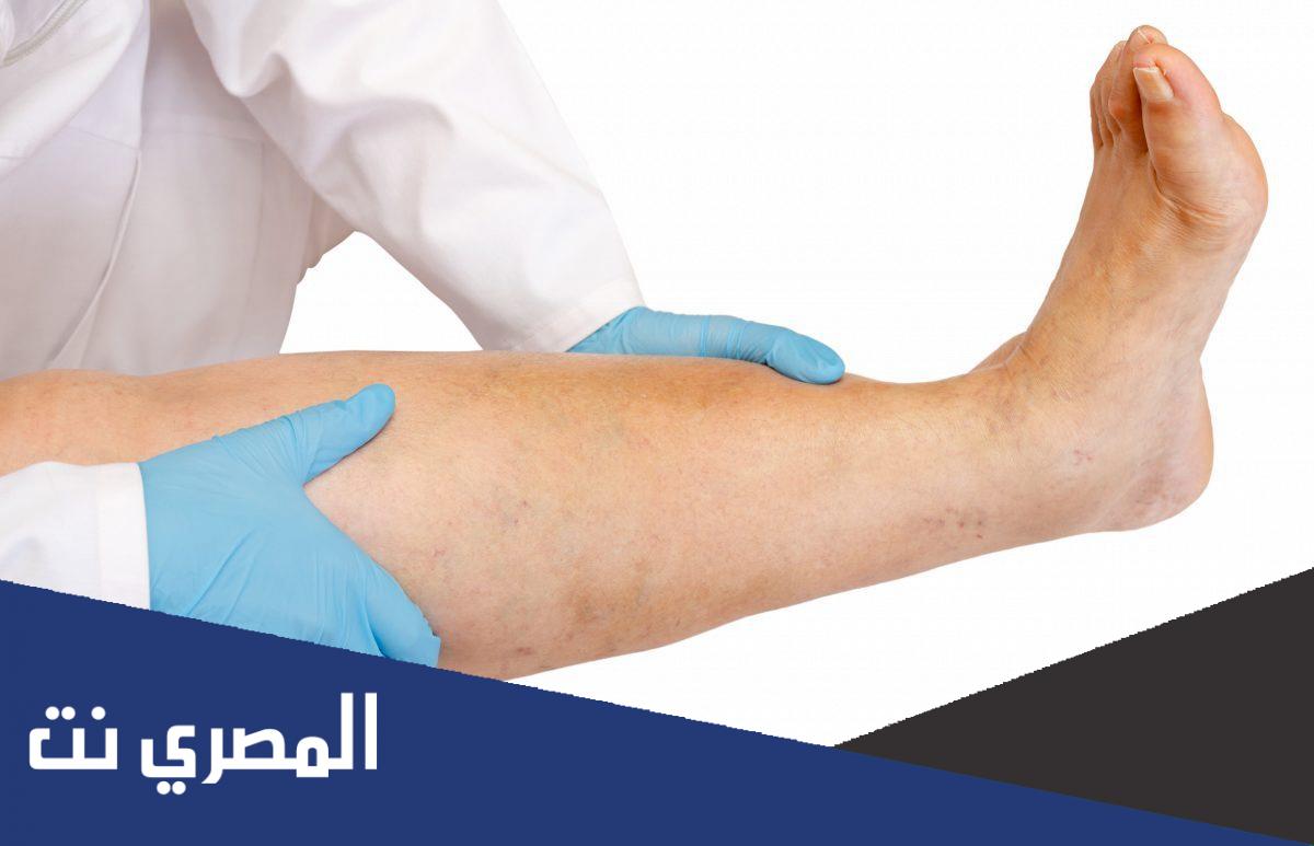 افضل مضاد حيوي لعلاج الالتهاب الخلوي
