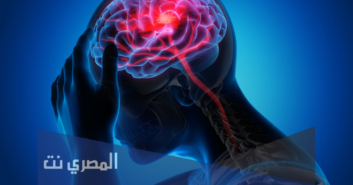 الرجة الدماغية وكيفية حدوثها وطرق علاجها