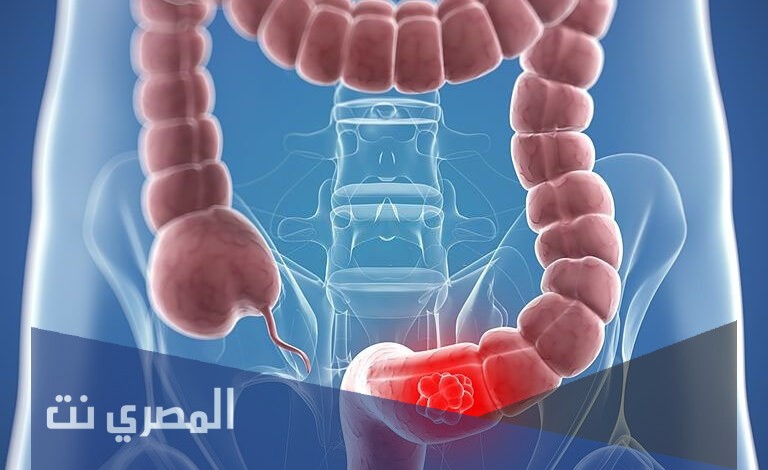 ميباجن Mebagen لعلاج القولون العصبي وتهدئته وتأثيره