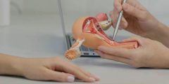 ما هي التهبيطات النسائية وجراحة المهبل التجميلية ؟