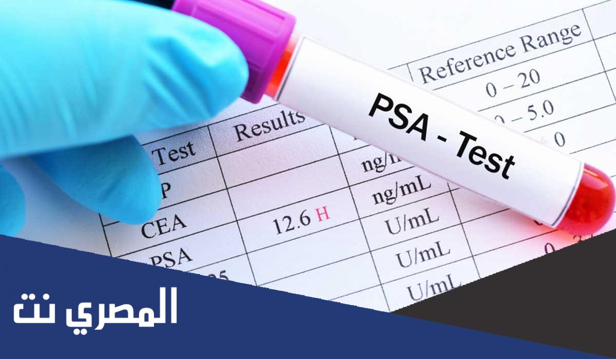 تحليل psa وكيفية قراءة 