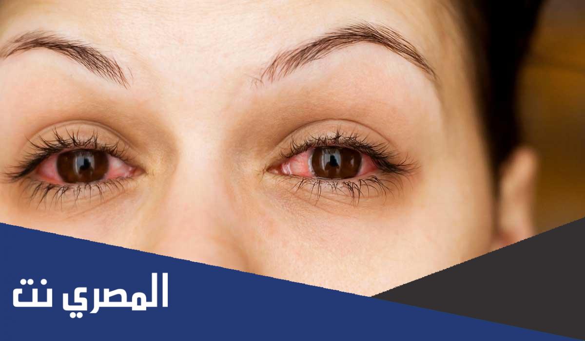دواعي استعمال قطرة أوركاديكسولين Orchadexoline والآثار الجانبية وأهم التحذيرات