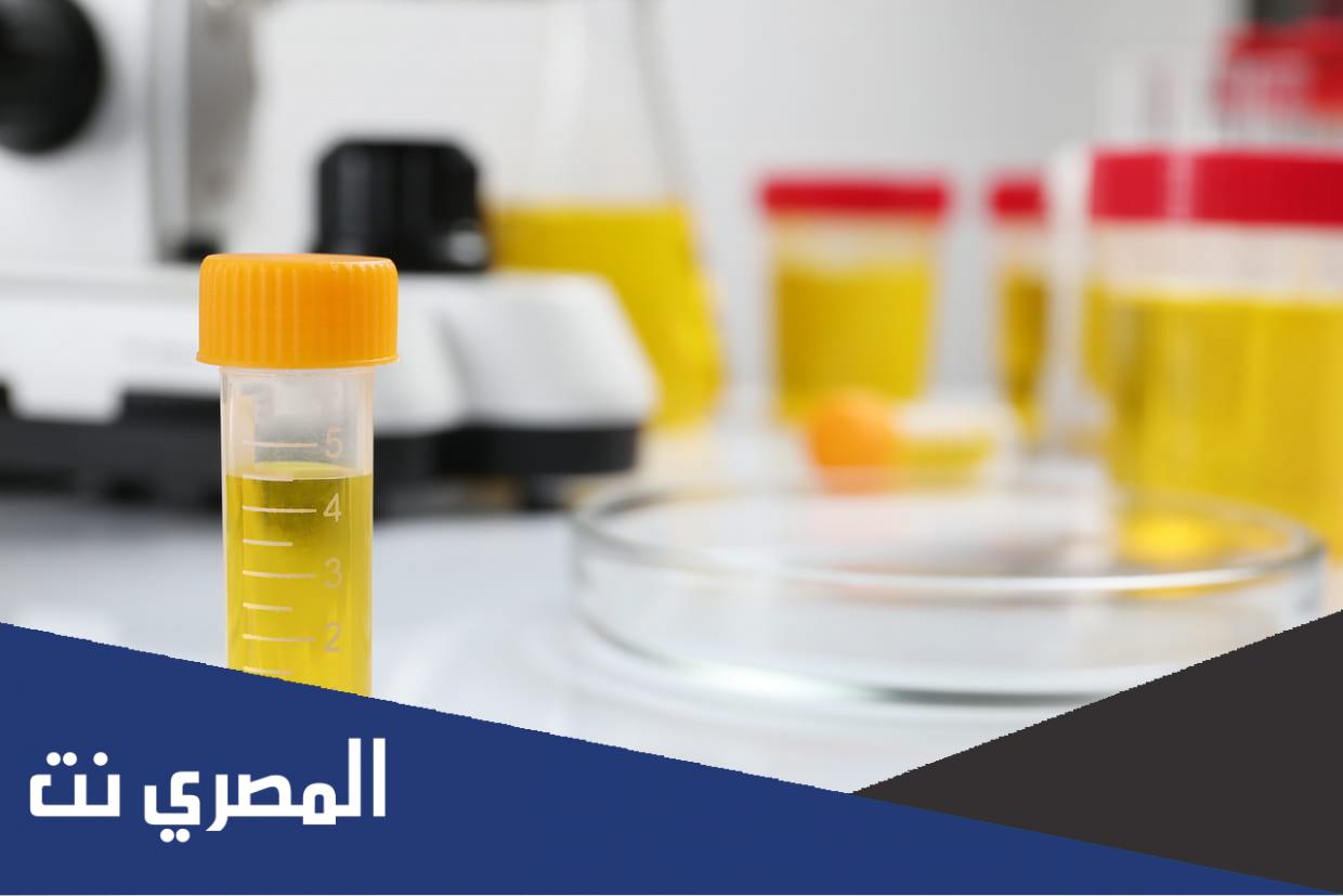 رائحة البول وكيفية علاجها