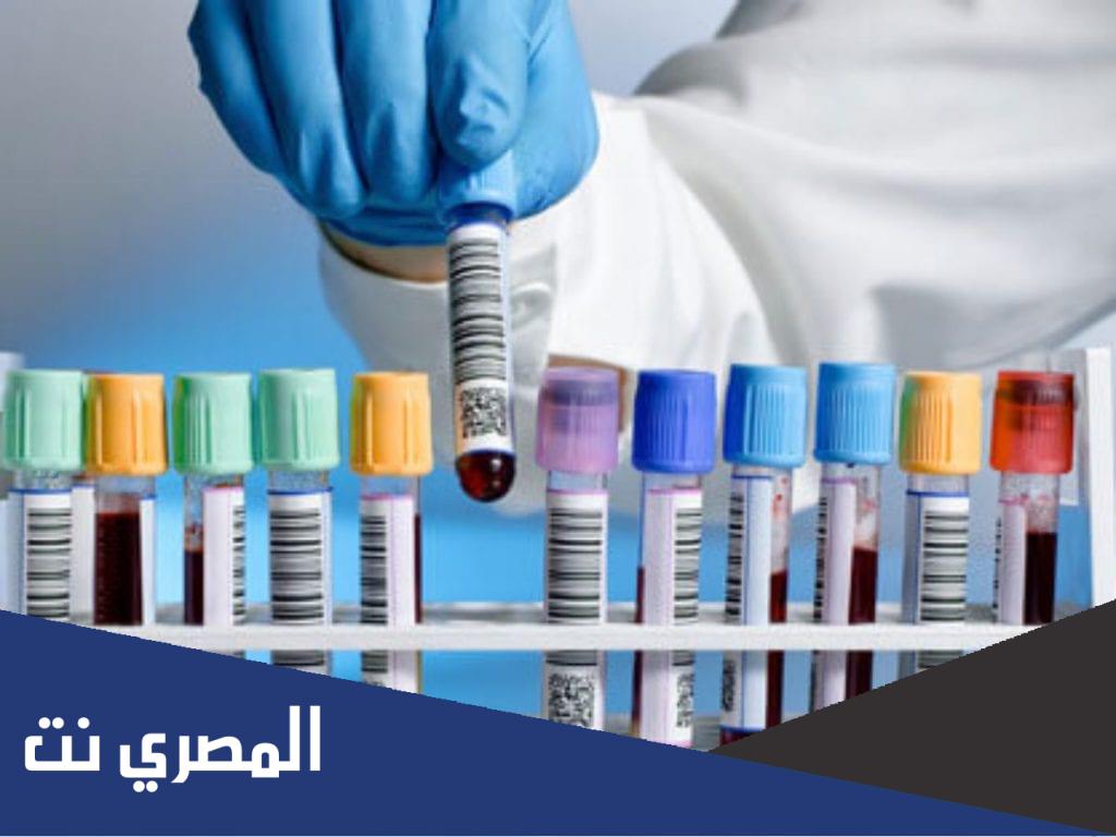 رموز التحاليل الطبية ومعدلاتها الطبيعية بالعربي