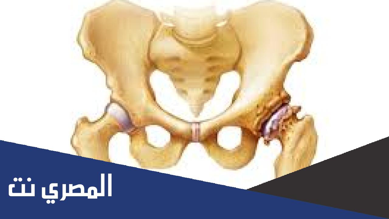 سبب خشونة مفصل الورك