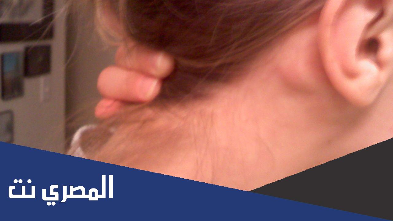 سبب ظهور ورم خلف الأذن