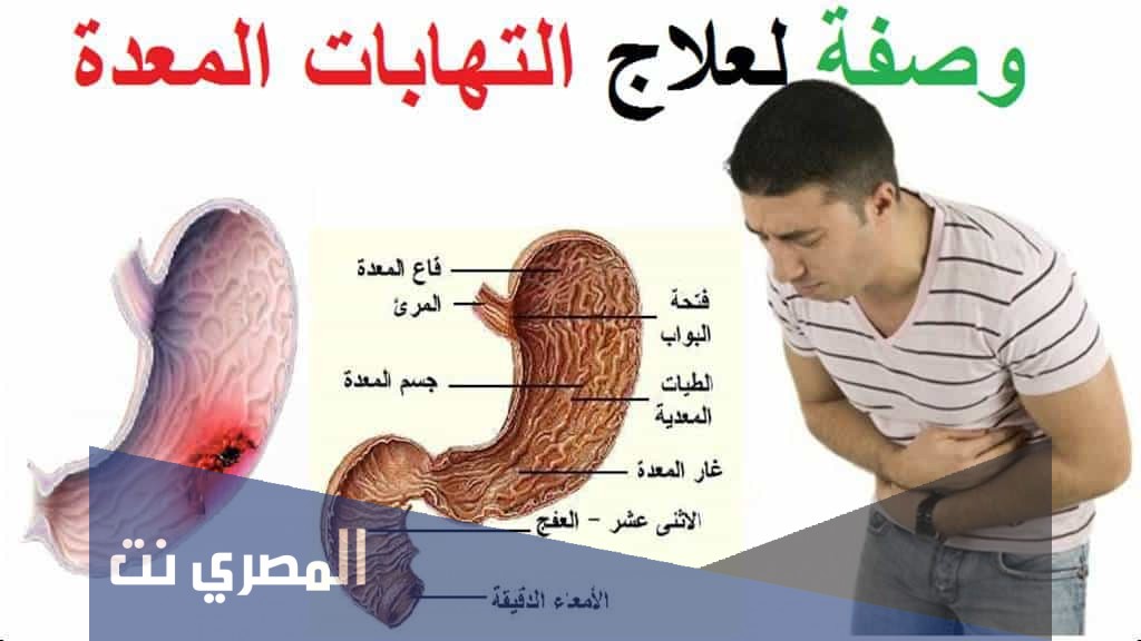 طرق علاج التهابات المعدة