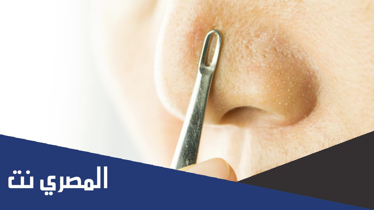 طريقة إزالة الرؤوس السوداء من الانف من أول مرة